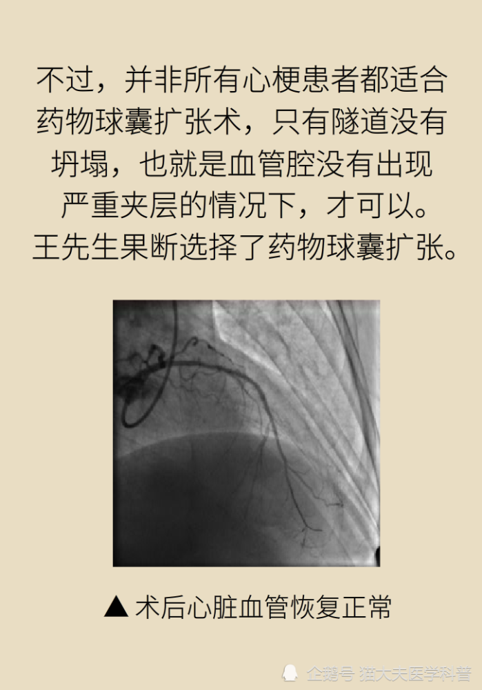 九成|年轻人猝死九成原因是它？想活命，跟老婆做好“五个约定”