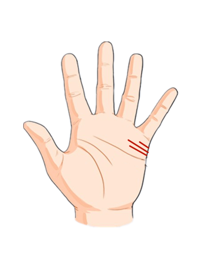 你知道注定二婚的女人手相特征是什么吗 腾讯网