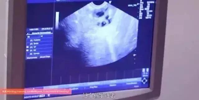 李玟|45岁李玟人工受孕9次失败，生子究竟为自己还是为婚姻？