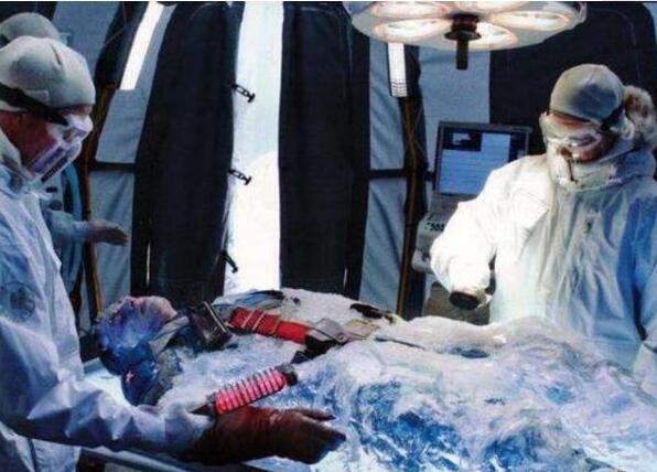 医学|50年过去了，世界首例“冷冻人”面临解冻，他复活了吗