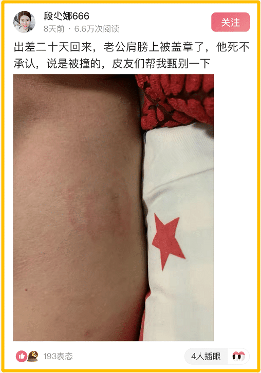 "出差20天回家,老公肩膀上被盖章了,我是不是被绿了?"哈哈哈哈哈