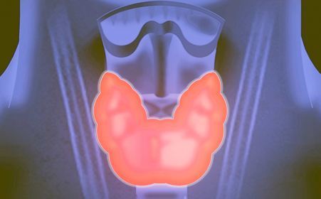 甲状腺结节|警惕！甲状腺结节四大危害，久拖易诱发癌变！