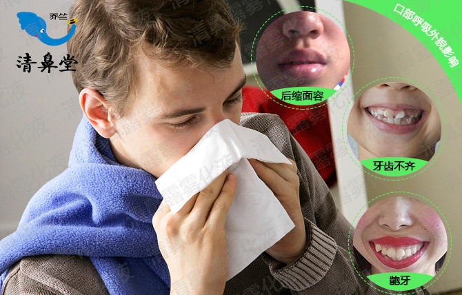 鼻炎|鼻炎患者的苦，只有鼻炎人才懂！