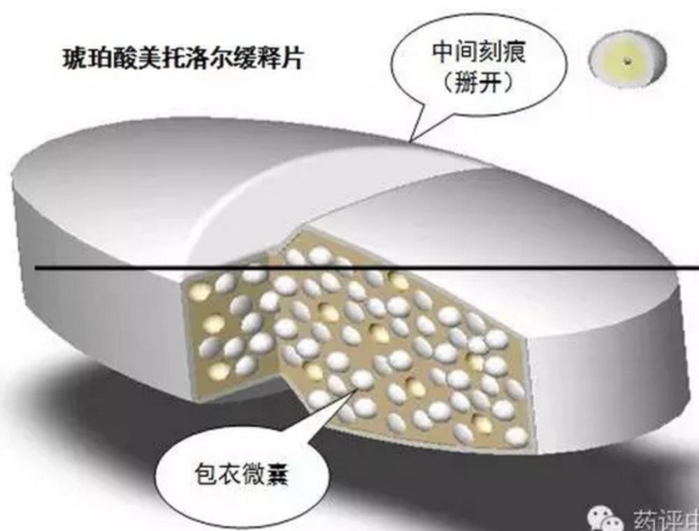 图3 琥珀酸美托洛尔缓释片结构示意图3,特殊人群,您该怎么办?