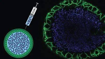 癌症|想不到的身体主宰：肠道菌群失衡可以致癌？