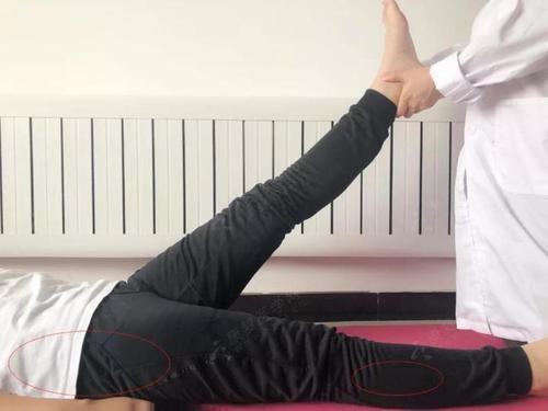 腰椎间盘突出症|你“腰突”了吗？教你一个简单的方法自测是否腰椎间盘突出