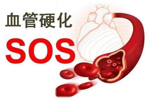 动脉硬化|动脉硬化的治疗方法