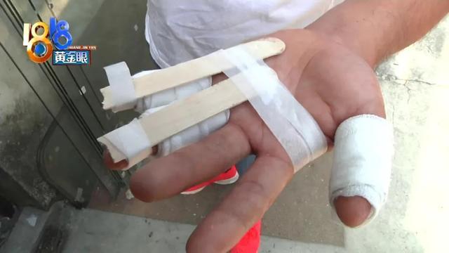 工人因钢化玻璃突然爆裂,手指严重割伤,厂家:玻璃质量没问题_腾讯新闻