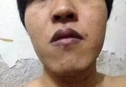 嘴唇一旦出现这个信号马上去医院