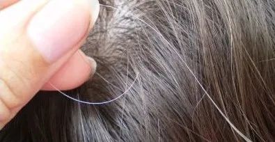 小朋友有白头发到底是怎么回事一夜愁白头是竟然是真的