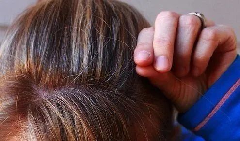 小朋友有白头发到底是怎么回事一夜愁白头是竟然是真的