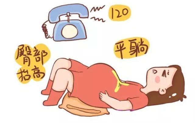 脐带跑赢了胎儿真的好吗关于脐带脱垂每个孕妈都该了解