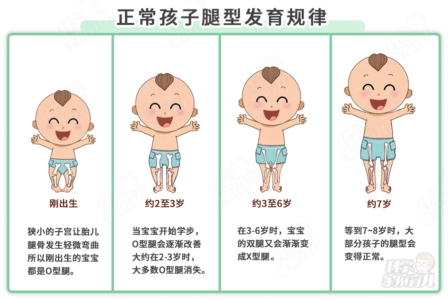 幼儿腿型发育图片