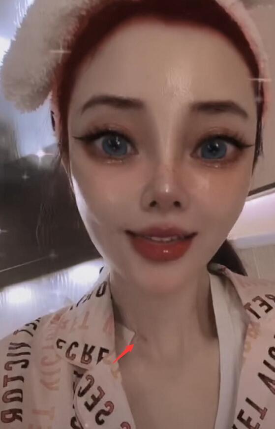 李小璐|李小璐晒自拍现吻痕，被疑与pg1复合？本尊辟谣：手术拆线所致