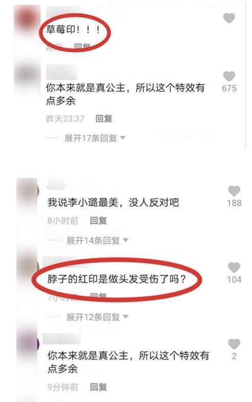 李小璐|李小璐晒自拍现吻痕，被疑与pg1复合？本尊辟谣：手术拆线所致