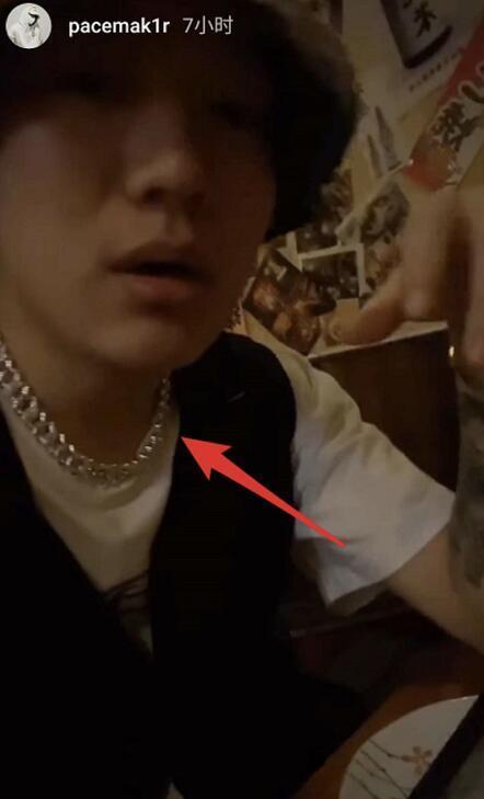 李小璐|李小璐晒自拍现吻痕，被疑与pg1复合？本尊辟谣：手术拆线所致