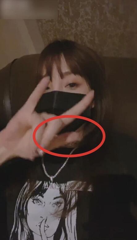 李小璐|李小璐晒自拍现吻痕，被疑与pg1复合？本尊辟谣：手术拆线所致