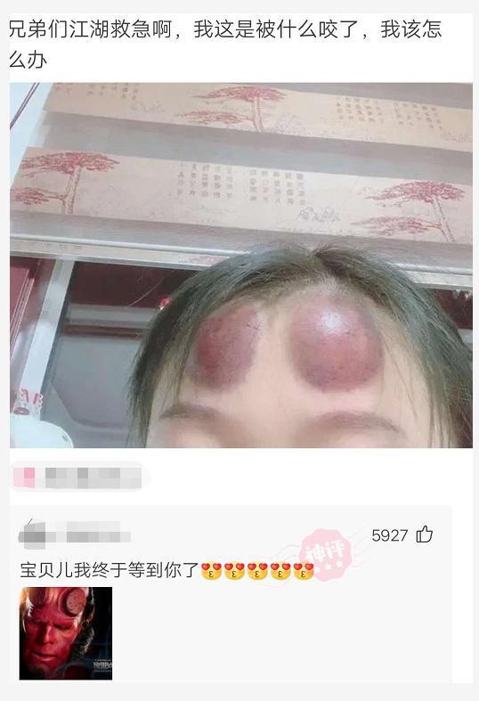 "头上被咬了两个包,我这是被什么咬了啊?"哈哈哈哈是地狱男爵吧!