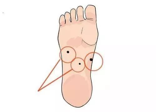 女子足底黑痣 竟成黑色素瘤 治疗会影响生育吗 黑色素瘤 色素痣 足底 Schink