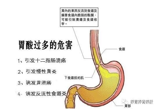 胃酸过多很难受告诉你几种缓解改善胃酸反流的方法