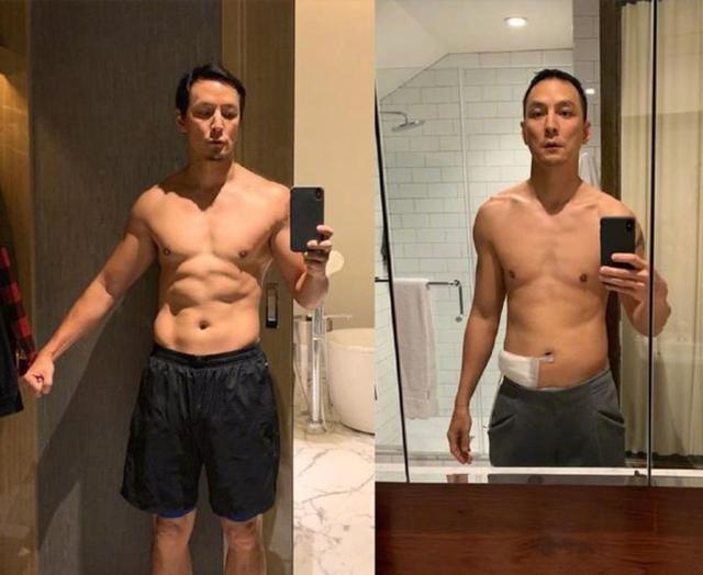吴彦祖阑尾炎复发,晒病床照脸色憔悴,曾因阑尾炎暴瘦16斤