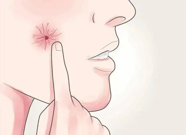 39岁男子,确诊肝癌,喝酒者,出现5种异常,去查查肝脏_腾讯新闻