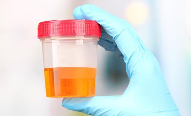 肝病|一旦被肝病盯上的人，上厕所时很容易出现这4种异常，别忽视了