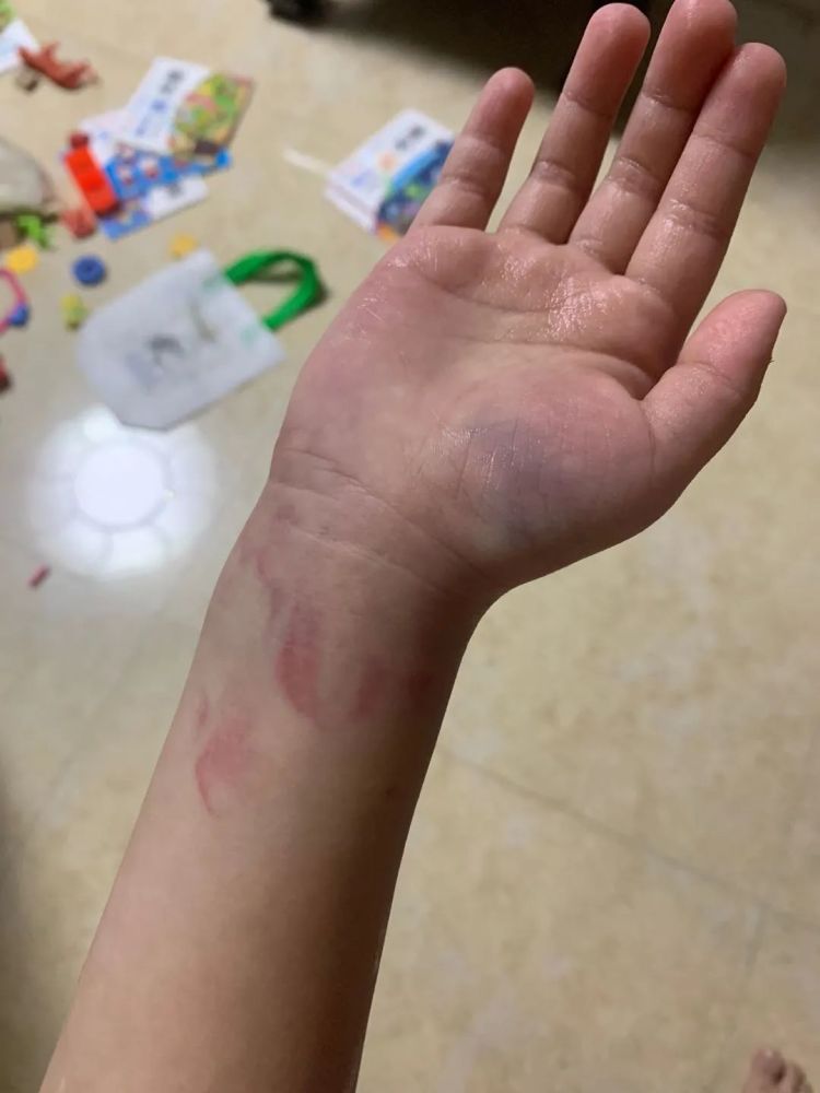 后续来了!揭阳华美实验学校教师体罚学生官方通报!