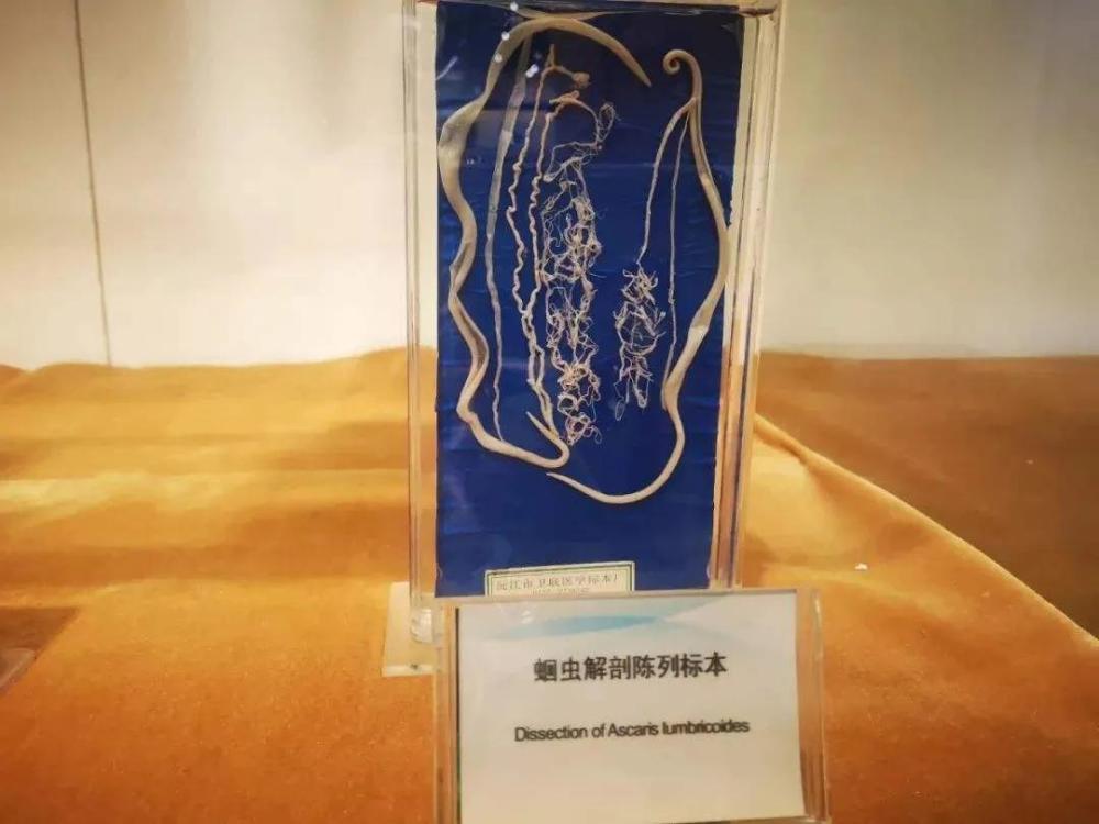 为了减肥,她们还有什么做不出?束腰,吃蛔虫,吞棉花,缩胃,催吐