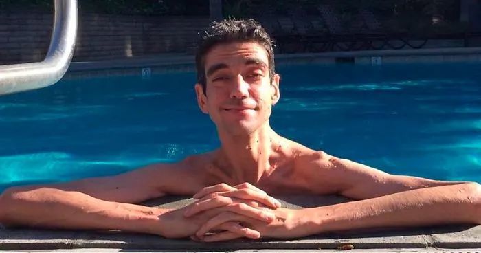 马凡氏综合征|因为基因突变他长成了网文男主的样子，但却因此只适合出演恐怖片