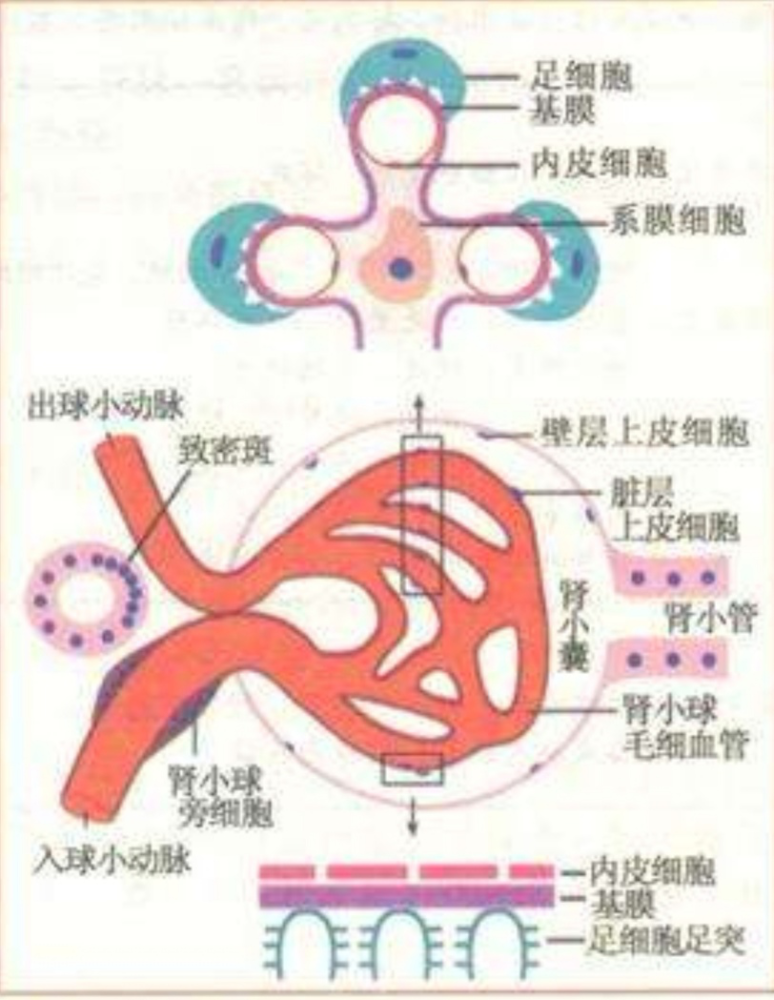 肾小球硬化|局灶节段性肾小球硬化的临床表现
