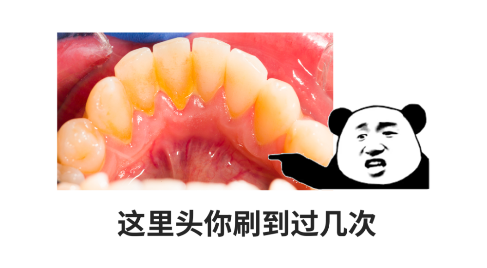 洗牙|每一个中国人，都应该好好去洗牙！