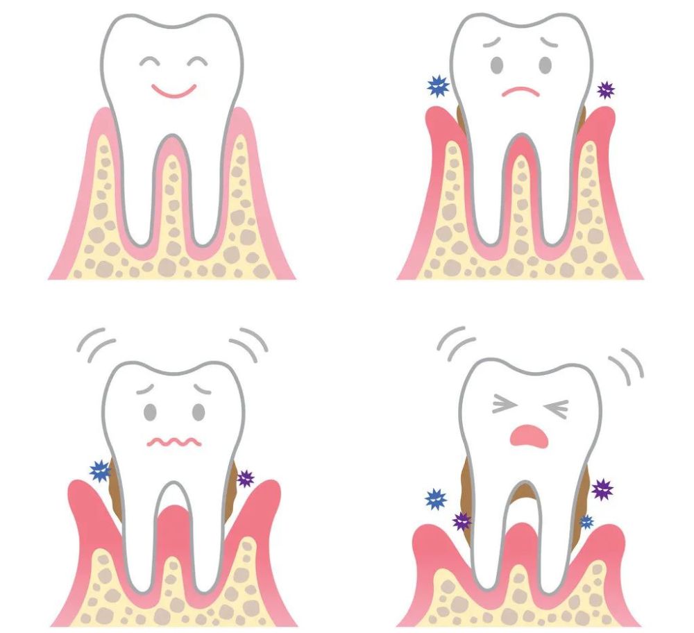 洗牙|每一个中国人，都应该好好去洗牙！