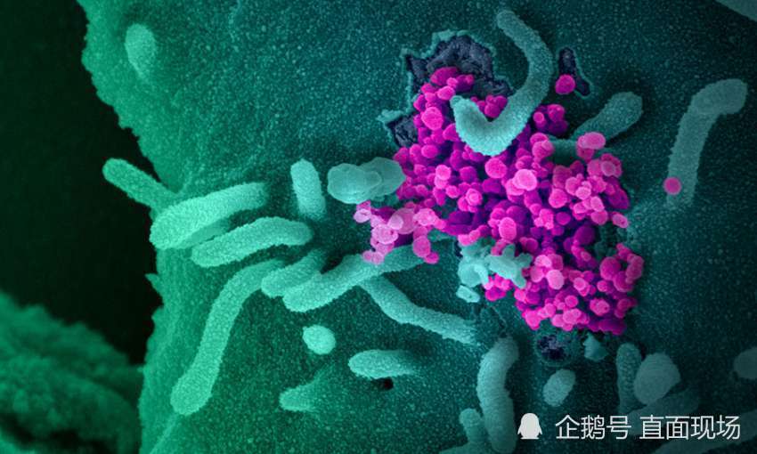 新冠病毒|新冠病毒有多顽强：用针刺100下 90度高温加热10分钟安然无恙