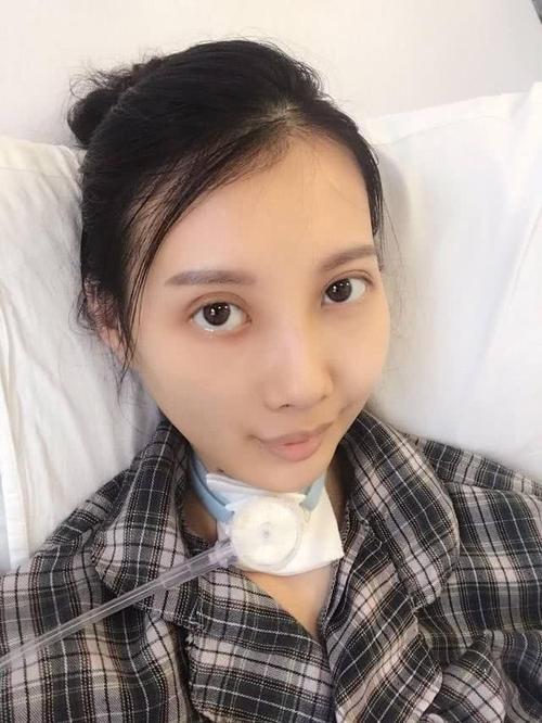 香港女星|香港女星李明蔚发视频筹款求助，抗癌8年五官已严重变形惹人怜