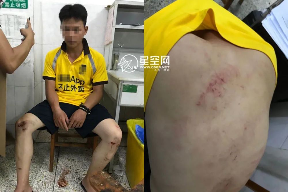 刷爆!潮汕外卖小哥取餐时遭多人暴打