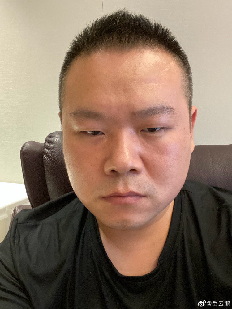 岳云鹏|下一个大衣哥？岳云鹏借钱申请表走红网络，背后的无奈让人心疼