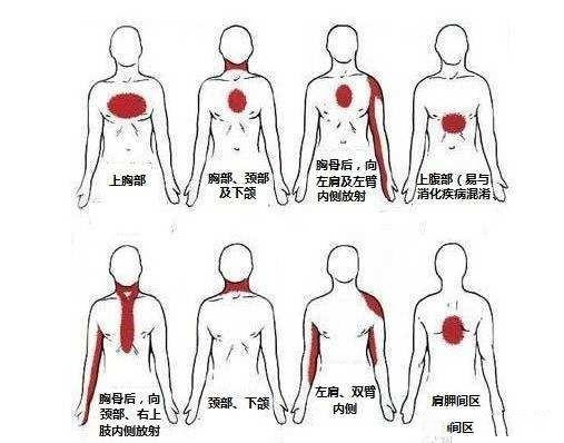 男性心脏疼痛的位置图图片