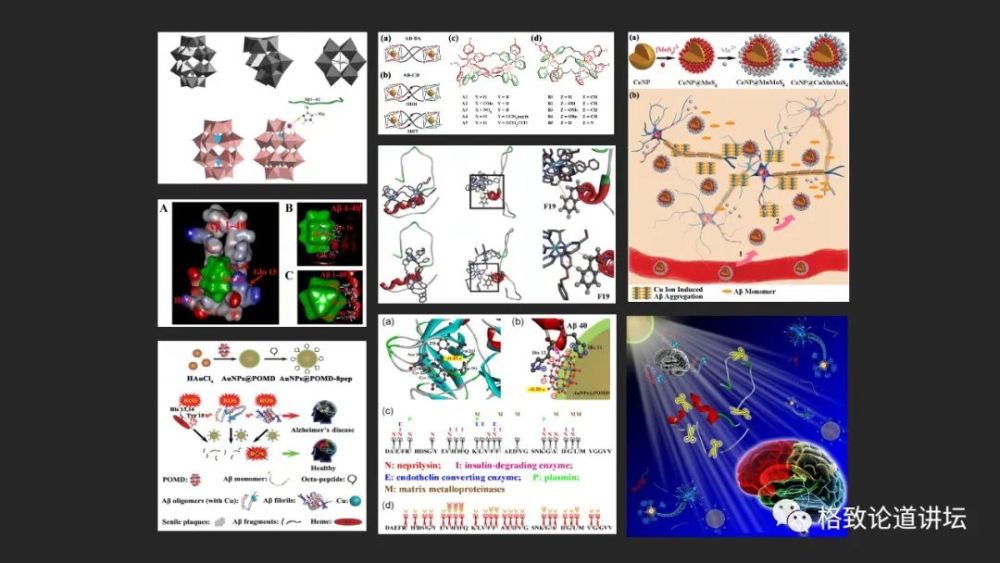 阿尔茨海默症|“百年孤独”的阿尔茨海默症，只有一个黄金治疗时间