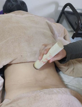 艾灸治疗突发腰痛这样操作!