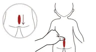 安军明教授谈小儿推拿:龟尾七节骨