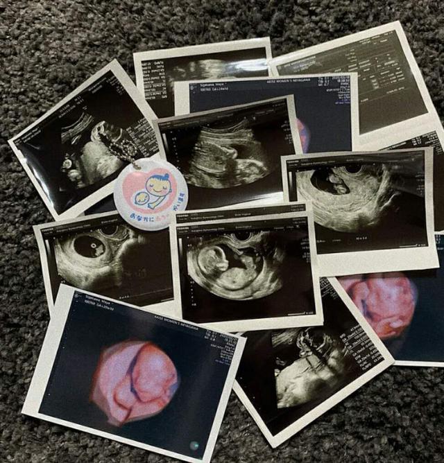 重川茉弥|16岁日本女星产后晒照，幼嫩似没生过！直言想返校读书兼顾家庭