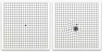 视力|视力模糊，易疲劳？可能是这些疾病的征兆，千万别忽视了