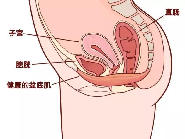 產後盆底肌修復和骨盆修復有何區別?該不該做骨盆修復?