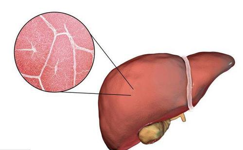 肝结节是什么肝结节超过多大会有危险