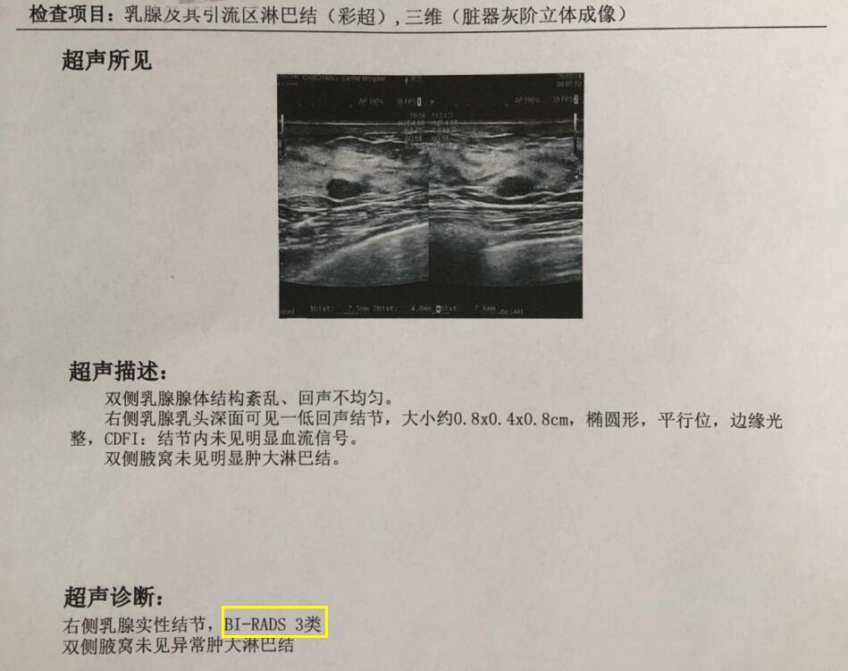 得乳腺结节5年认真散结半年分享7个散结的细节