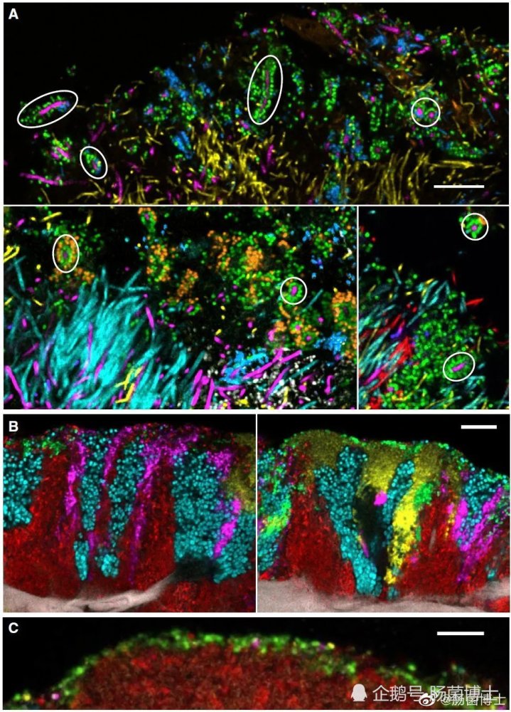 微生物|口臭由微生物引起？让我们来近距离看一看，口腔里的微生物
