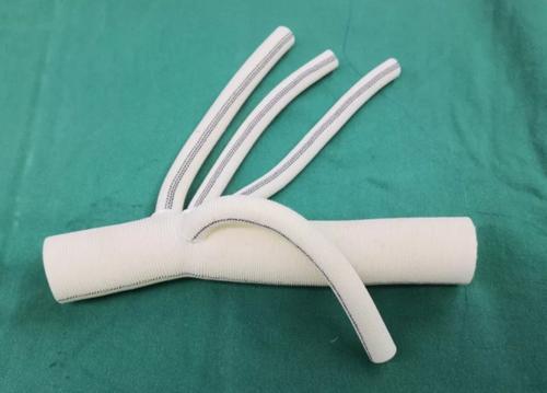 人工血管的寿命多少?