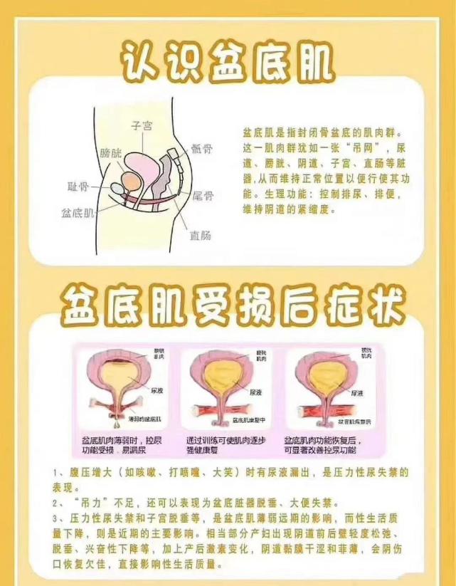 产后总感觉下面有东西掉出来是怎么回事别大意可能是子宫脱垂