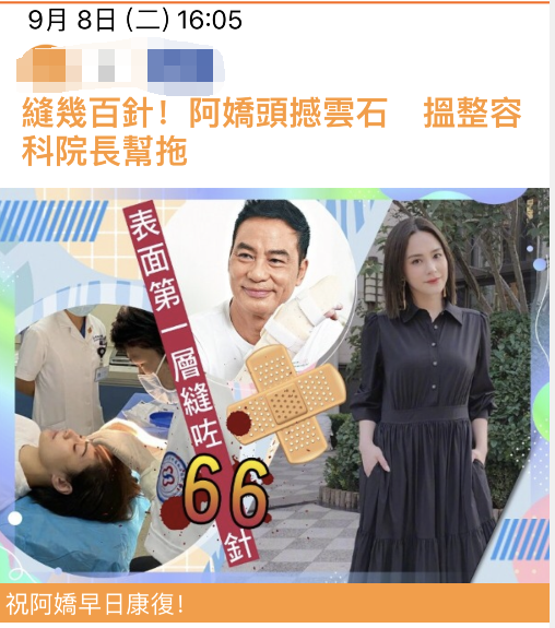 钟欣潼|阿娇术后半月复工高清照曝光，戴口罩帽子不见右眉伤口，清瘦不少